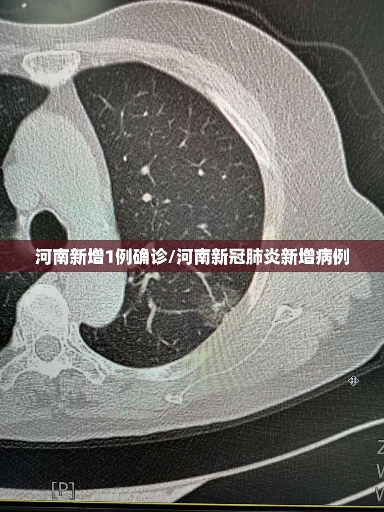 河南新增1例确诊/河南新冠肺炎新增病例