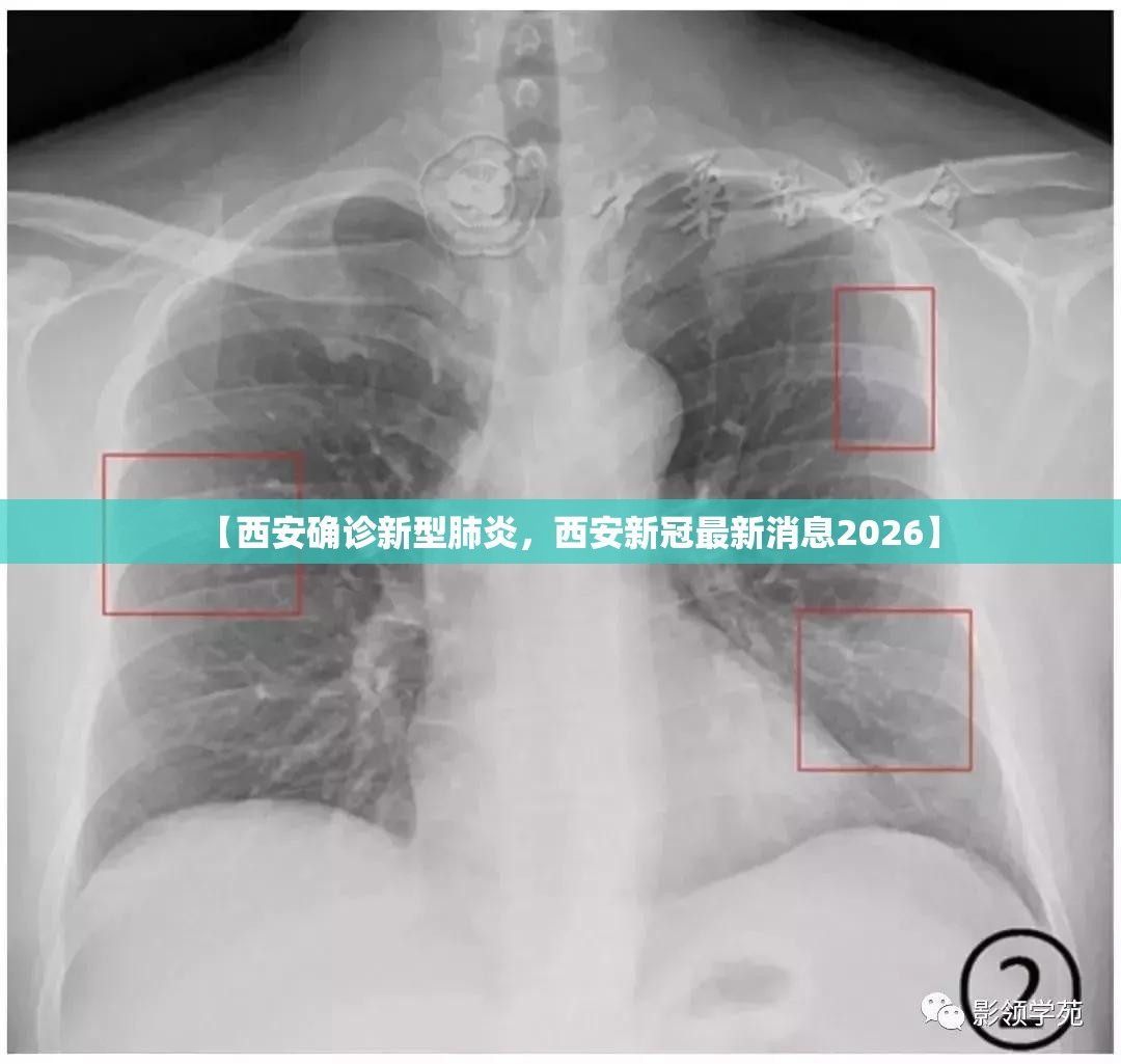 【西安确诊新型肺炎，西安新冠最新消息2026】